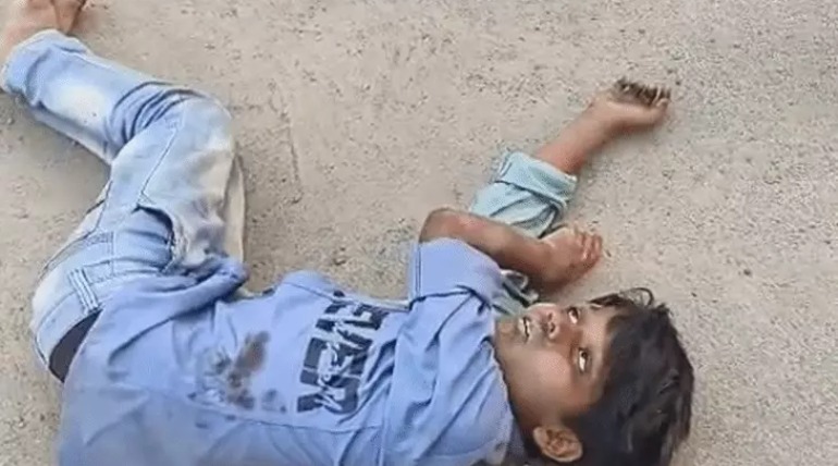 पेट में सरिया घुसने से बच्चे की मौत, साइकिल लेकर खुले नाले में गिरा, ठेकेदार पर लापरवाही का आरोप