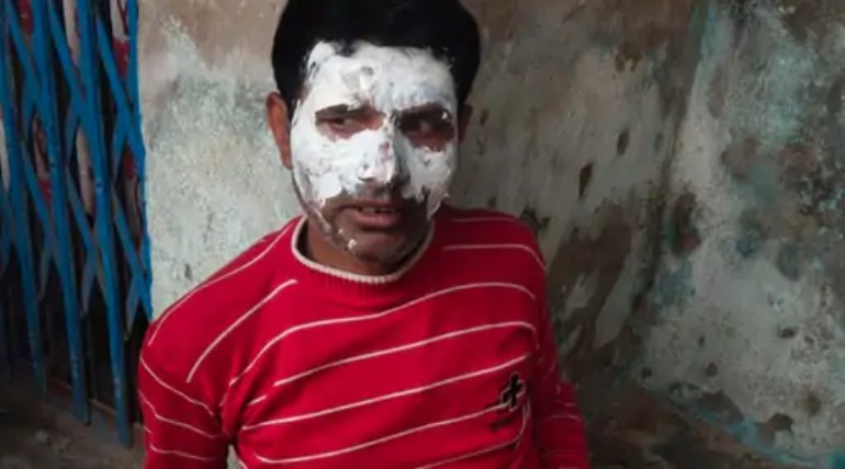 खाना बनाते समय फटा सिलेंडर, राजस्व विभाग की टीम मौके पर पहुंची