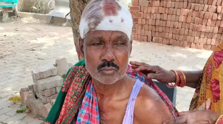 बेटे ने जमीन विवाद में पिता को पीटा, मां-बहन भी घायल