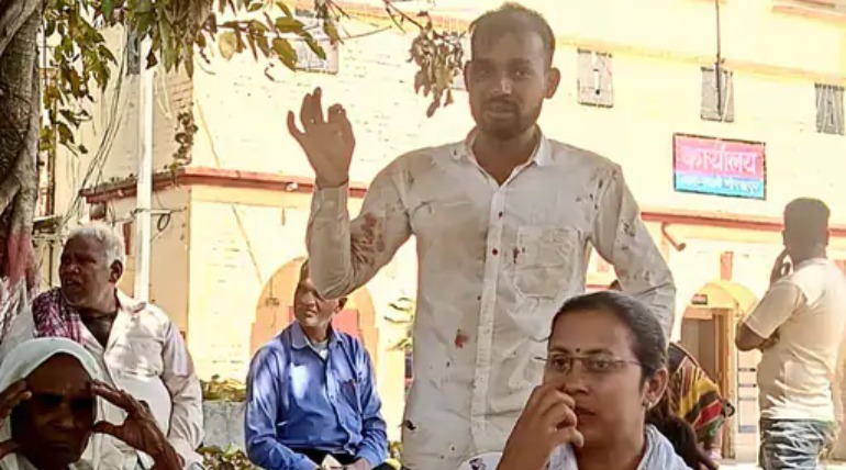 युवक की बेरहमी से पिटाई, युवक ने पत्नी और उसके प्रेमी पर लगाया मारपीट का आरोप