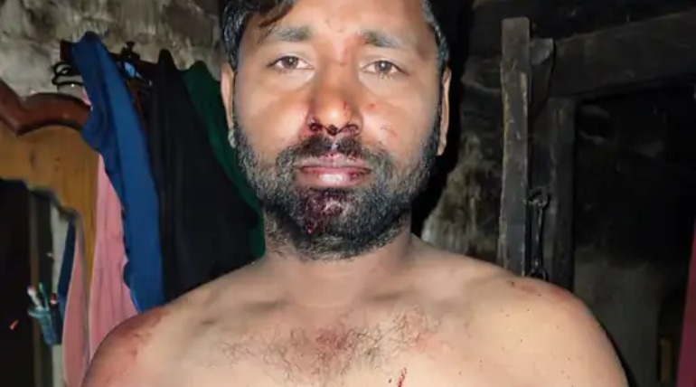 जमीनी विवाद को लेकर पति-पत्नी को पीटकर किया घायल, तहरीर दी