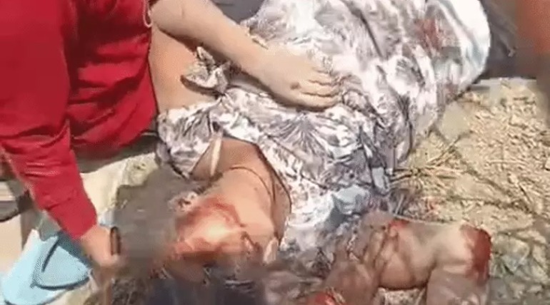 स्टंट करते बाइक सवार किशोर युवती से टकराया, 2 की हालत गंभीर, 3  बाइकों पर थे 9 युवक, घायलों को छोड़ भागे