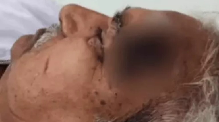 पूर्व मंत्री का हथौड़े से सिर फोड़ा, ताबड़तोड़ वॉर कर घायल किया, घर के बाहर कर रहे थे वॉक