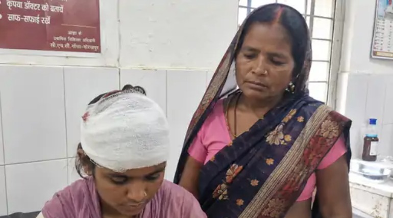 पेड़ की डाल विवाद में मां-बेटी पर हमला, बेटी का सिर फटा, चार नामजद आरोपियों पर केस दर्ज