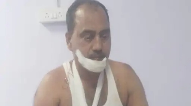 ट्रैक्टर-ट्रॉली की टक्कर से बैंक गार्ड घायल, हेलमेट पहनने से बची जान, चालक मौके से फरार