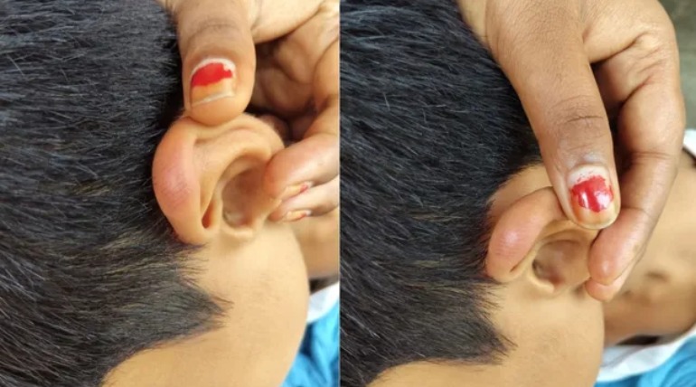 प्लास से नोचे कान, पैरों पर मारा हथौड़ा...